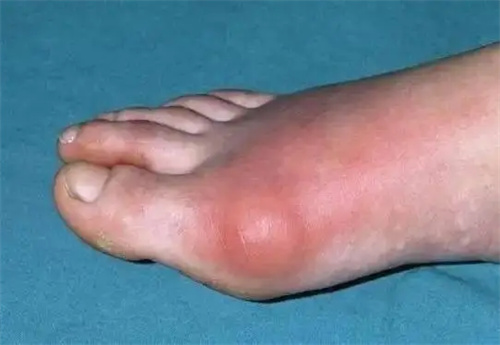 细节呈现