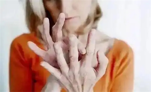 细节说明