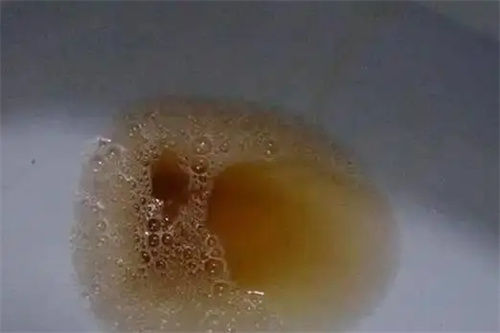 详细介绍