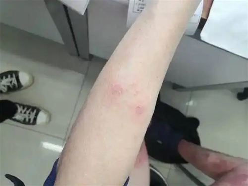 详细介绍