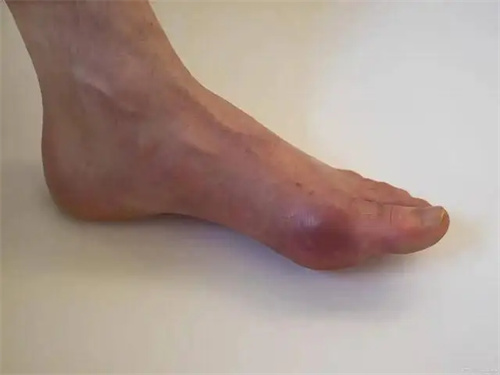 细节呈现