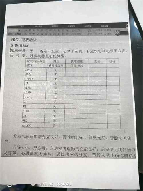 细节介绍