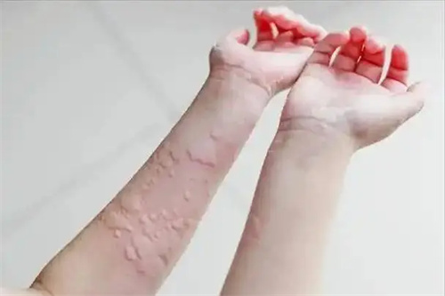 详细说明