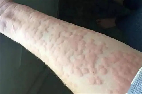 细节呈现