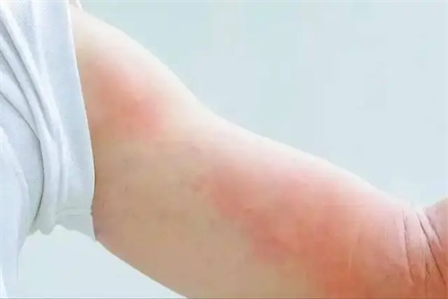 细节介绍