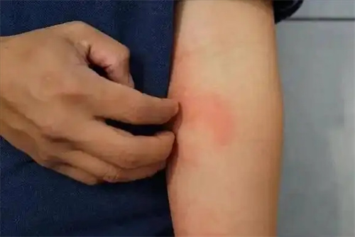 细节介绍