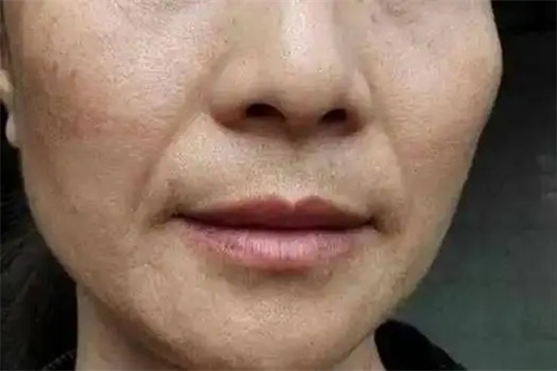 细节呈现