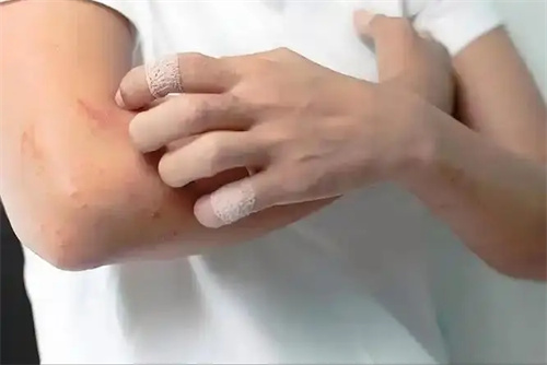 细节介绍