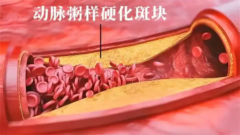 细节呈现