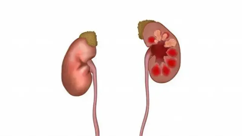 详细说明